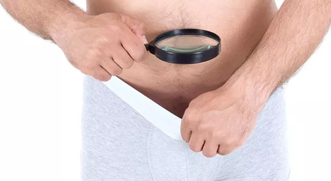 ¿Qué es la vasectomía sin bisturí?
