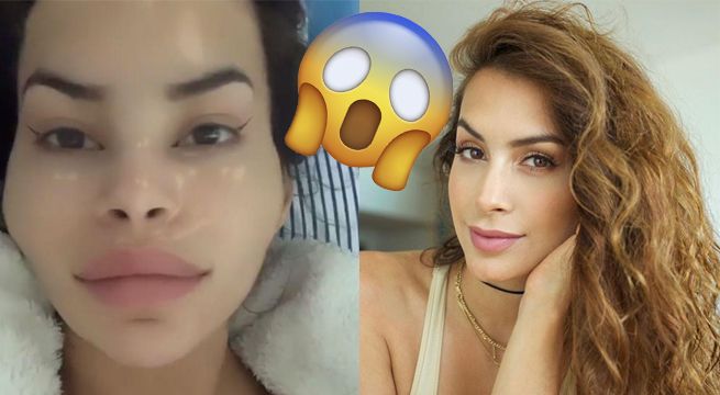Milett Figueroa sorprende a todos al deformarse el rostro [FOTO]