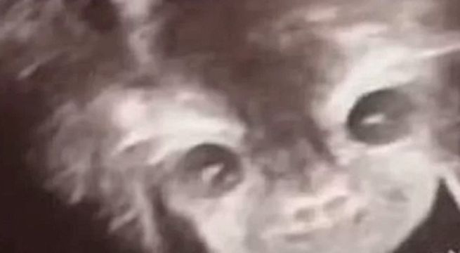 Mujer quedó aterrada al conocer el rostro de su bebé en ecografía