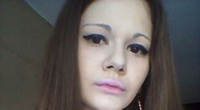 Joven se sometió a 15 cirugías y muchos aseguran que arruinó su vida 
