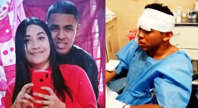 Mujer roció combustible y quemó el rostro de su expareja