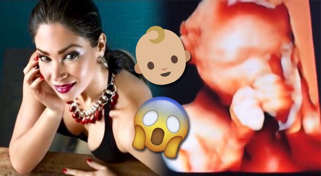 Melissa Loza sorprende a todos al anunciar su embarazo en las redes sociales