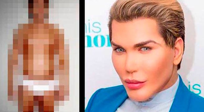 “Ken Humano” sorprende en las redes con extracción de una parte de su cuerpo 