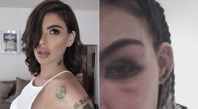 Válgame Dios: ¿Quién golpeó a Angie Jibaja?