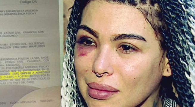 Válgame Dios: pareja de Angie Jibaja relató la brutal agresión que sufrió la modelo