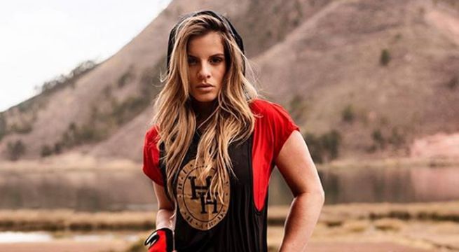 ¿Alejandra Baigorria abusó del uso de bótox en su rostro?