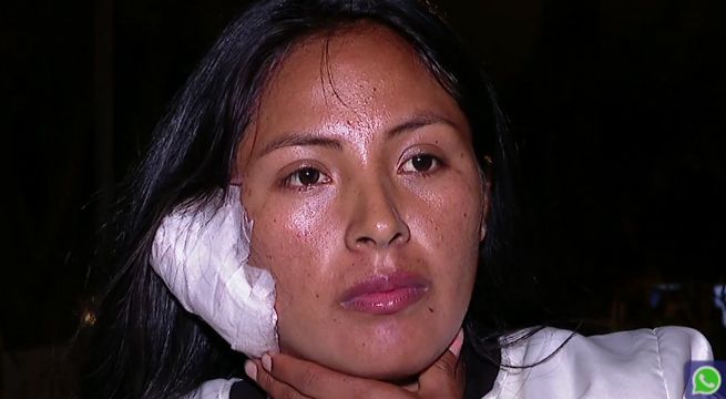 Mujer le arrancó la oreja con la boca a rival durante pelea en El Agustino [VIDEO]