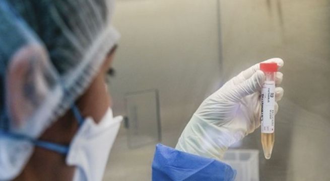 INS crea propuesta de prueba molecular para diagnóstico de COVID-19 en menos de una hora