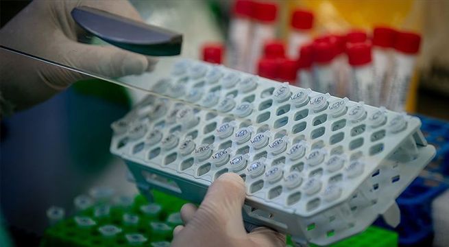 Tratamiento con medicamentos para el VIH no muestra buenos resultados contra el coronavirus