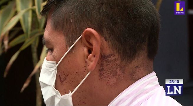 Liberan a mujer que lanzó ácido muriático a esposo [Video]