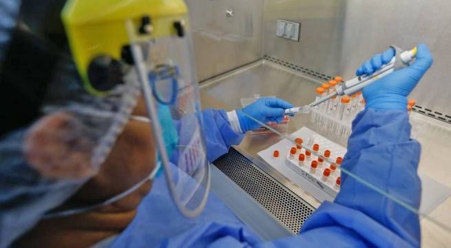 Covid-19: ¿Cuándo usar una prueba molecular, antígena o serológica?