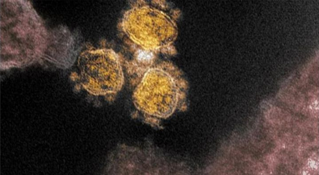 Muertes a causa del Covid-19 en el mundo superan los 3,5 millones