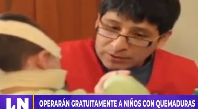 Operarán gratuitamente a niños con quemaduras y labio leporino