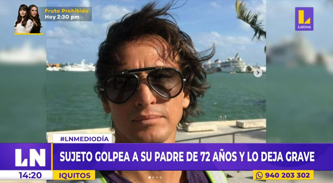 Iquitos: sujeto golpea a su padre de 72 años y lo deja malherido