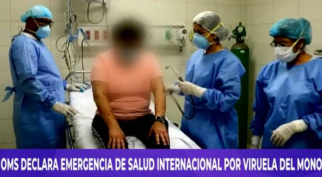 OMS declaró emergencia de salud internacional por viruela del mono