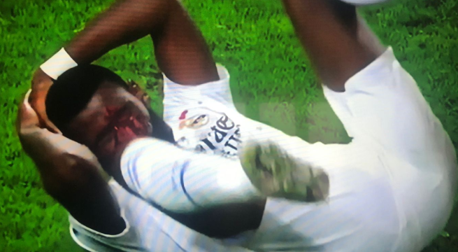 Antonio Rüdiger sufrió un terrible golpe en el agónico empate del Real Madrid