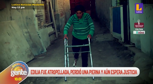 Mujer atropellada por conductor en estado de ebriedad perdió una pierna y reclama justicia
