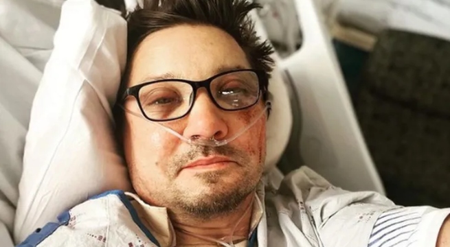 Jeremy Renner compartió la primera foto después de su accidente: “Estoy hecho un desastre”