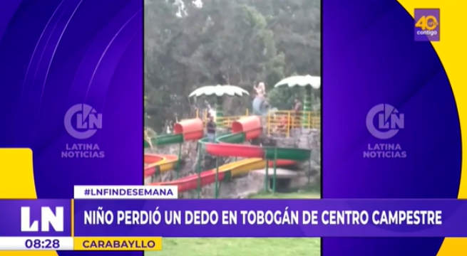 Niño pierde un dedo mientras se deslizaba en tobogán de club campestre