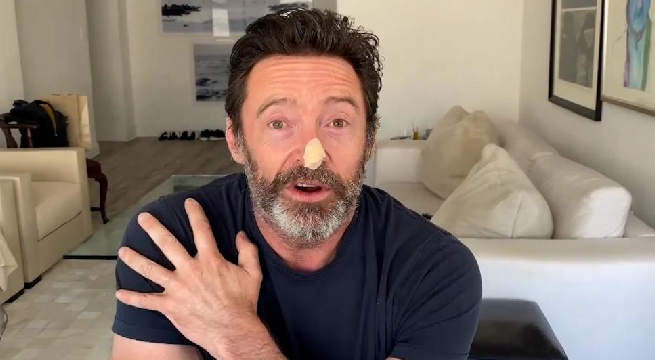 El actor Hugh Jackman recibió el alta médica ante cáncer de piel