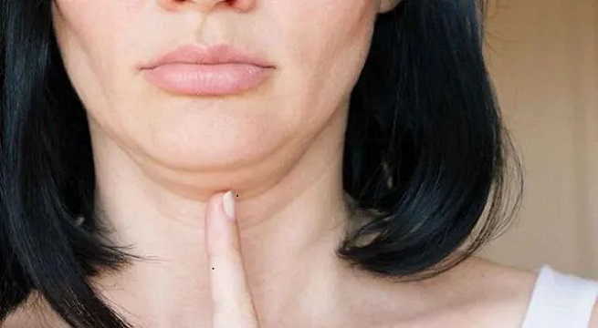 Aceite para bajar la papada: así se prepara la receta natural