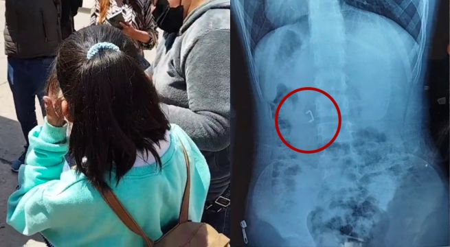 Cusco: madre denuncia que su hija es víctima de bullying