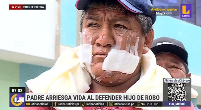 Padre termina con el rostro desfigurado tras defender a su hijo de un robo