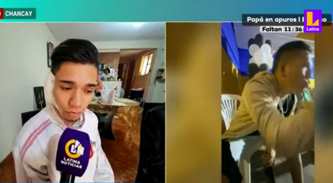Chancay: cantante arranca oreja de un mordisco a colega en concierto