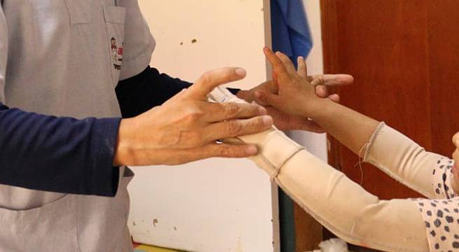 Presentan campaña para apoyar a 100 niños sobrevivientes de quemaduras