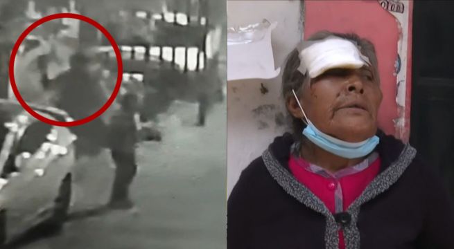 Comas: hombre golpea con un ladrillo a anciana de 75 años
