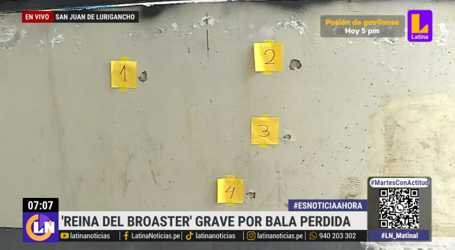 SJL: Bodeguera se encuentra en UCI tras bala perdida