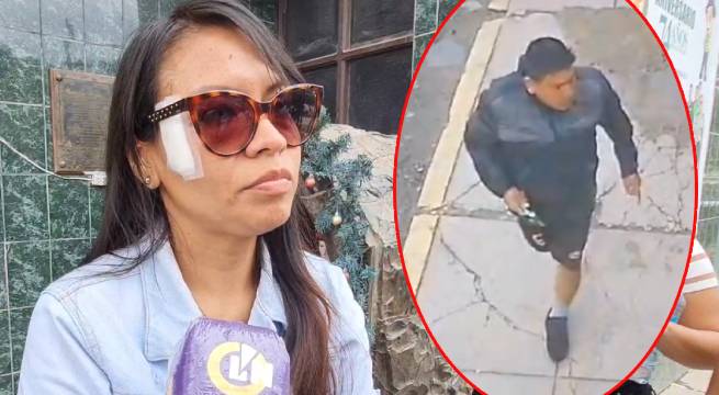 Expareja ataca a mujer con una cuchilla y le desfigura el rostro