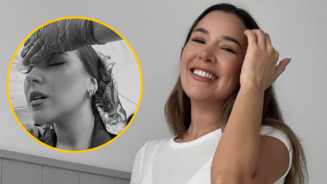 Ale Fuller tras sufrir quemaduras en 'El Gran Chef Famosos: La Revancha': 