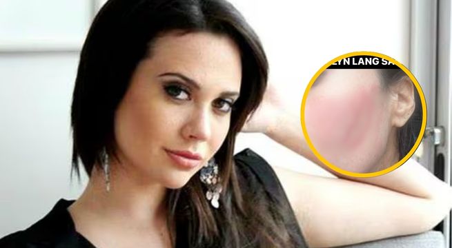 Lucía Oxenford denuncia que fue agredida brutalmente por mujer tras defender a perrito