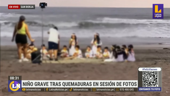 Menor se encuentra en UCI tras sufrir quemaduras en sesión de fotos | VIDEO