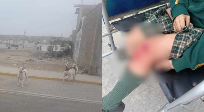 Menor queda herida tras brutal ataque de perros pitbull [FOTO]