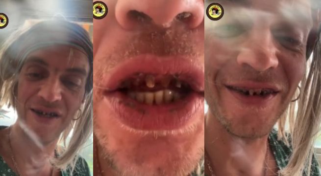 Hijo de Camilo Sesto aparece irreconocible y sin dientes
