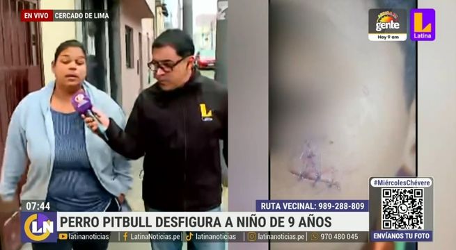 Menor termina con el rostro desfigurado tras ataque de perro