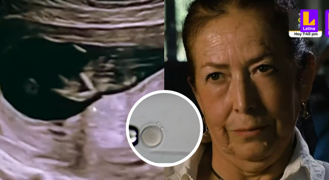 Madres gracias a la ciencia: logró quedar embarazada a los 49 años