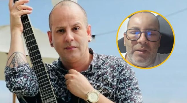 Ricky Trevitazzo aparece en redes con el rostro hinchado y preocupa a fans