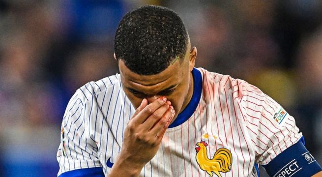 Kylian Mbappé termina con la nariz rota tras duro choque en partido de la Eurocopa [VIDEO]