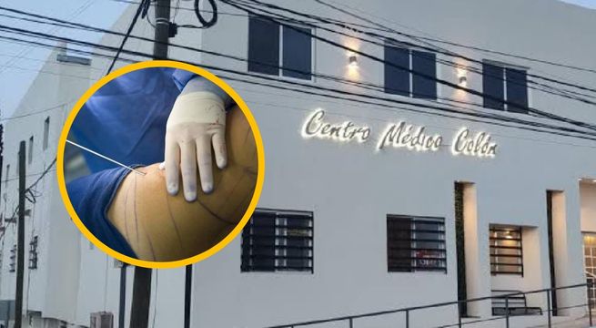 Mujer pierde la vida tras someterse a liposucción en México
