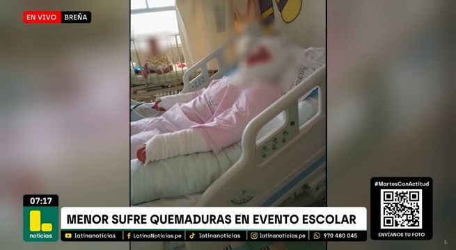 Menor sufre quemaduras en evento escolar: profesor le lanzó líquido por error