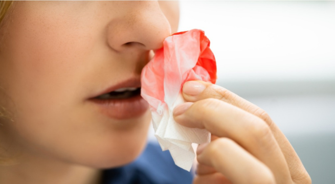 Perú reduce las infusiones para hemofilia con nuevo tratamiento: ¿de qué trata?