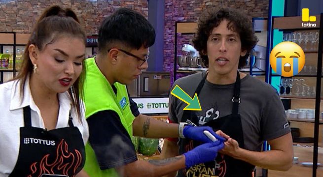 El Gran Chef Famosos: Mateo Garrido Lecca SE CORTA el dedo EN VIVO, ¿cómo?