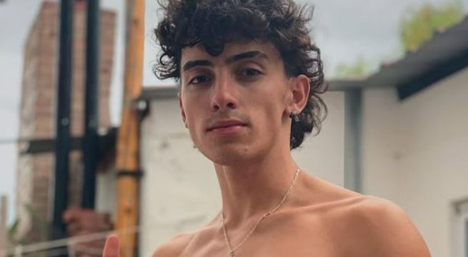 Influencer Gero Arias sufrió grave accidente y perdió dos dedos de la mano