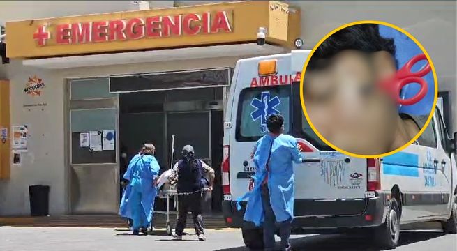 Adolescente ataca a su amigo y le incrusta una tijera en la cara [FOTO]