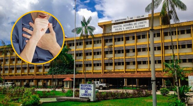 Alerta en Loreto por brote de tos ferina: varios muertos y 490 casos confirmados