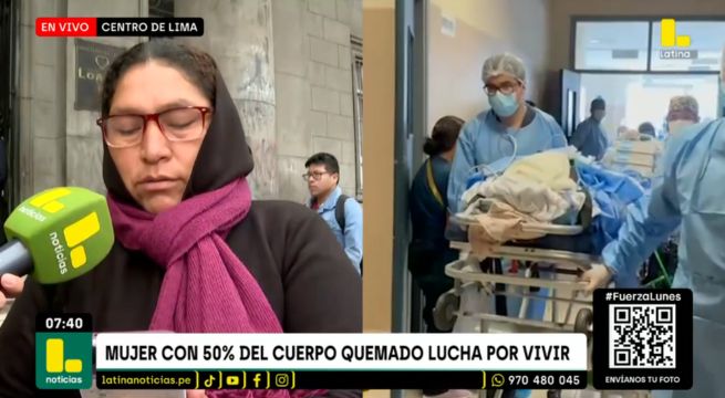 Mujer con el cuerpo quemado lucha por su vida: madre sospecha de su pareja