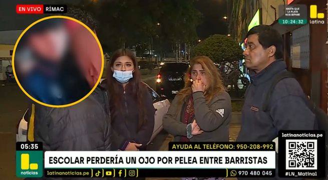 Escolar podría perder la vista tras explotarle una bombarda en pelea de barristas